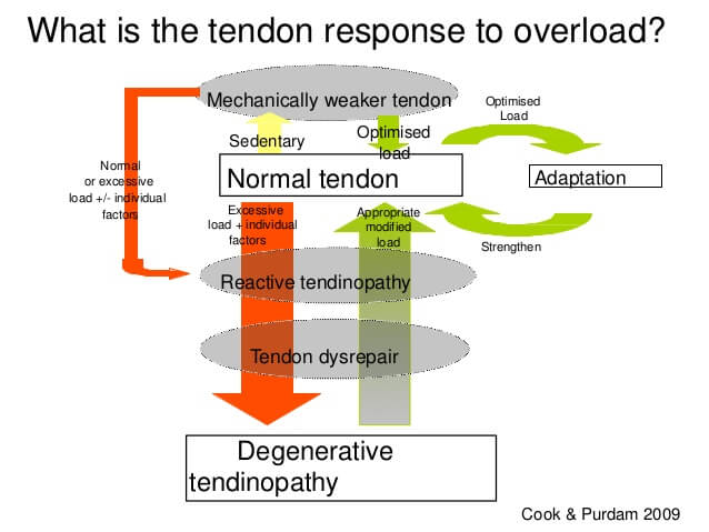 Image: graphic showing the normal and pathological tendon loading cycle